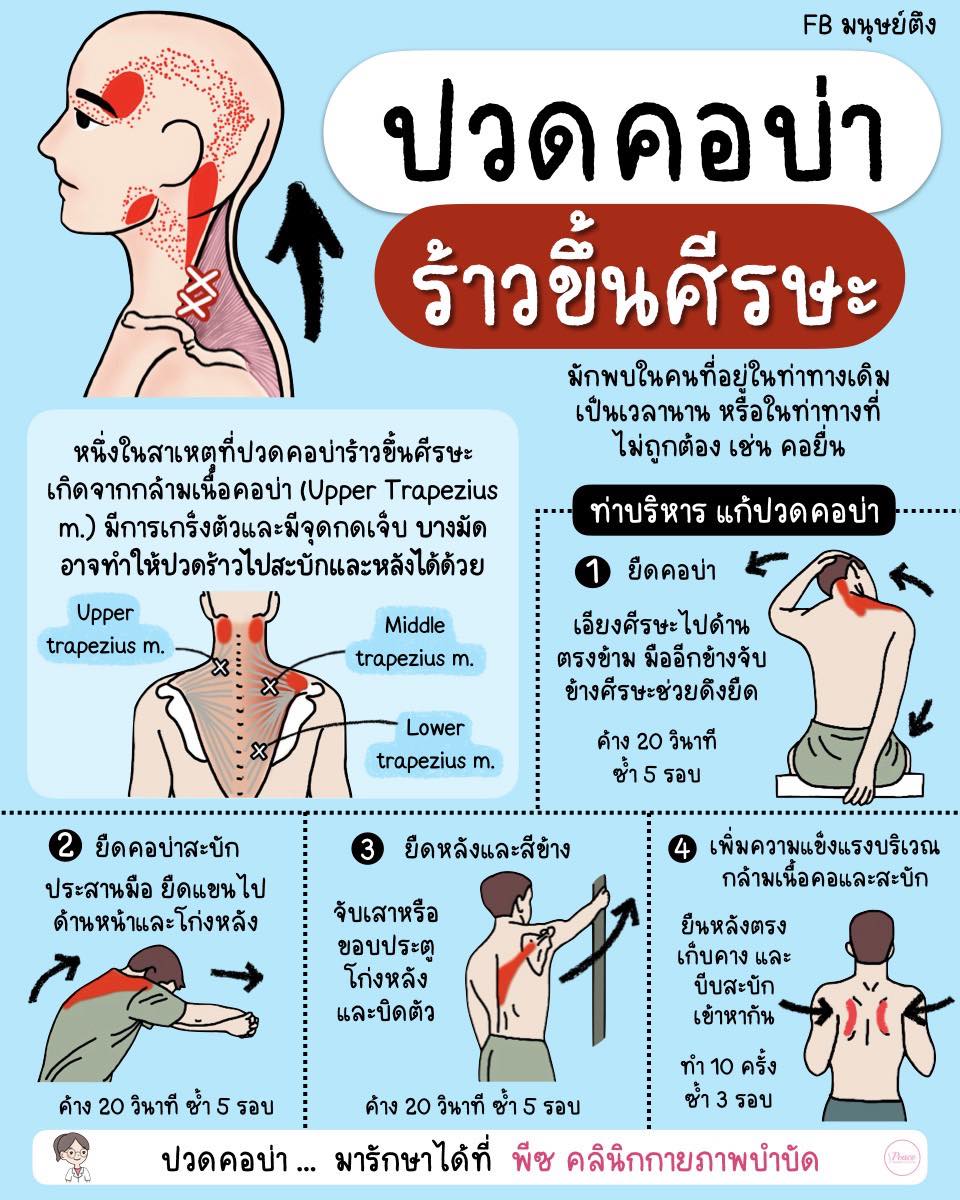 ปวดคอบ่า ร้าวขึ้นหัว ‼️ #รักษาอาการปวดไมเกรนเทียม